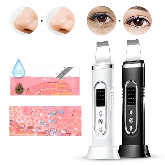 4348 WC VIP Beauty Ultrasonic Electric Skin Scrubber Blackhead Removal