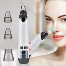 4348 WC VIP Beauty White / 172 x 35 x 35 MM Blackhead Remover Tool