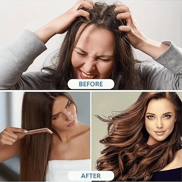 15pcs No-Rinse Hair Caps for Postpartum, Elderly & Post-Surgery Care – Water-Free Hair Washing