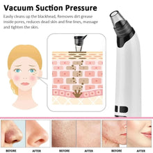 4348 WC VIP Beauty White / 172 x 35 x 35 MM Blackhead Remover Tool